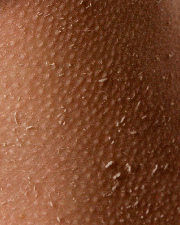 EXFOLIATE